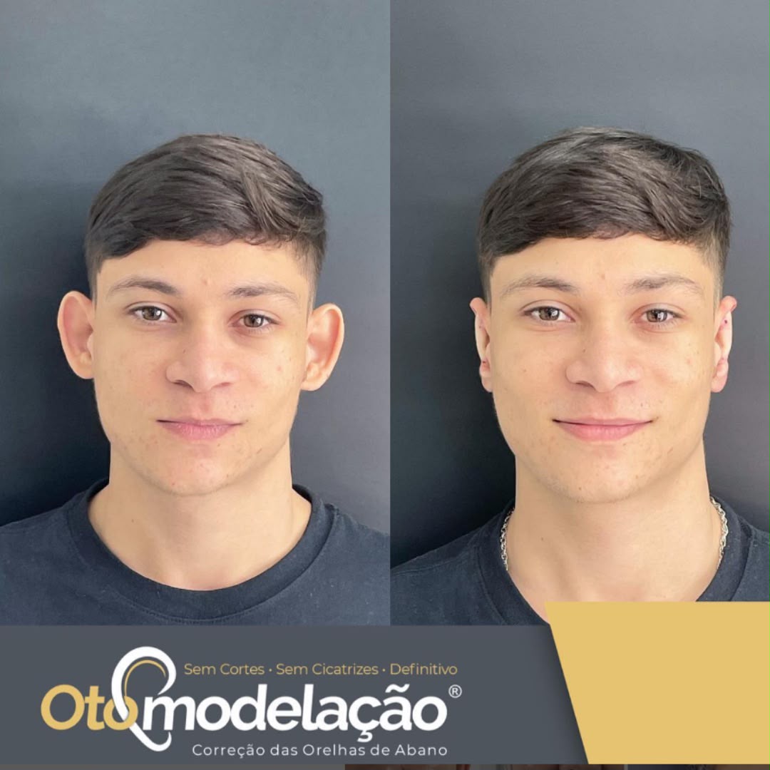 Vagas 100% gratuitas para a rede pública