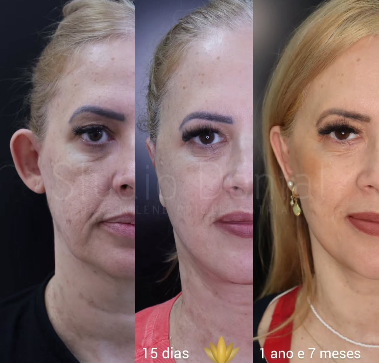 Infância vivida de cabeça erguida