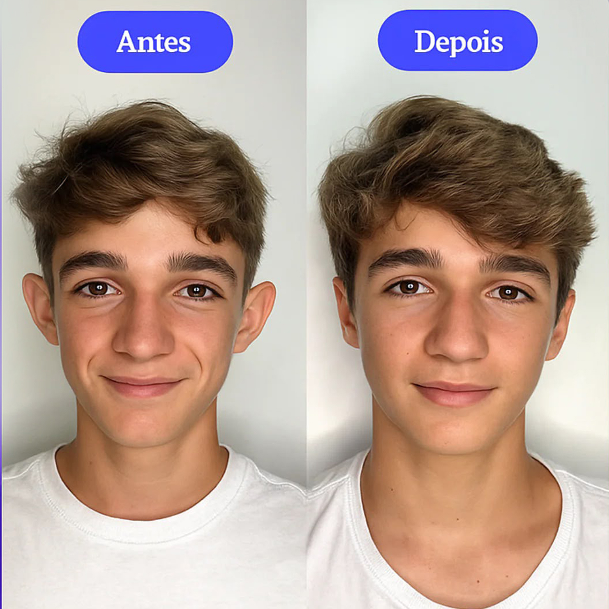 Criança sorrindo com confiança após tratamento de autoestima